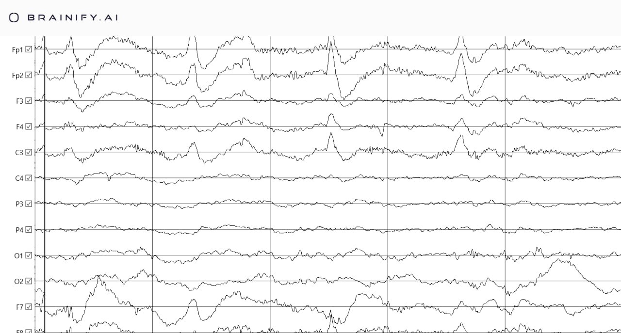 Brainify.ai — AI-Powered Brain Diagnostics Platform